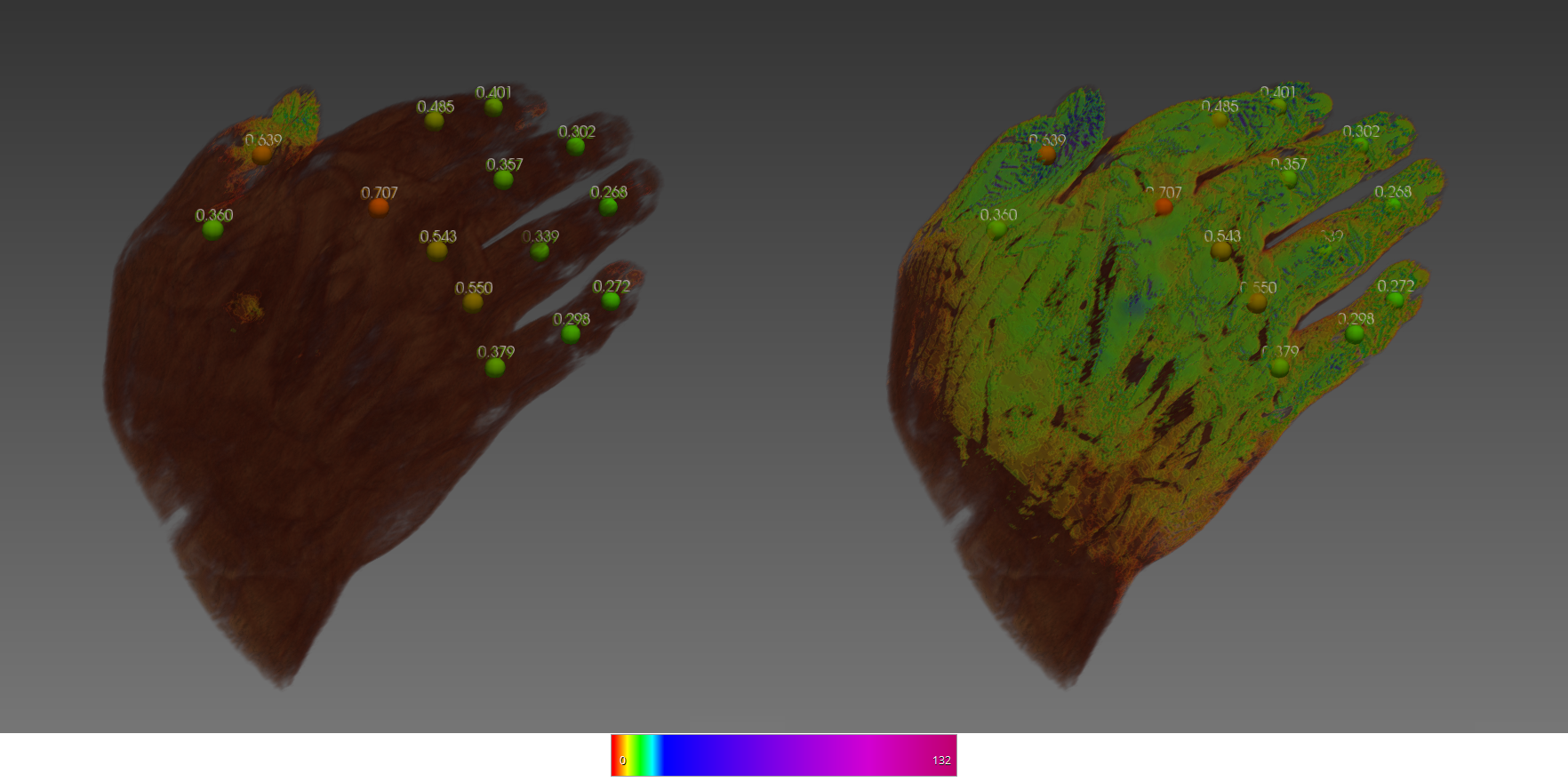 Exemplary visualization of the area scores resulting from the evaluation of fluorescence optical imaging in combination with the volume-registered fluorescence optical image series and the corresponding MRI of the hand. The left image is in the early stage of fluorescence agent influx, the right image was taken at a later stage.